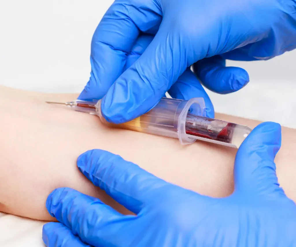 Profesional de la salud con guantes azules realizando una extracción de sangre del brazo de una paciente mediante una jeringa.